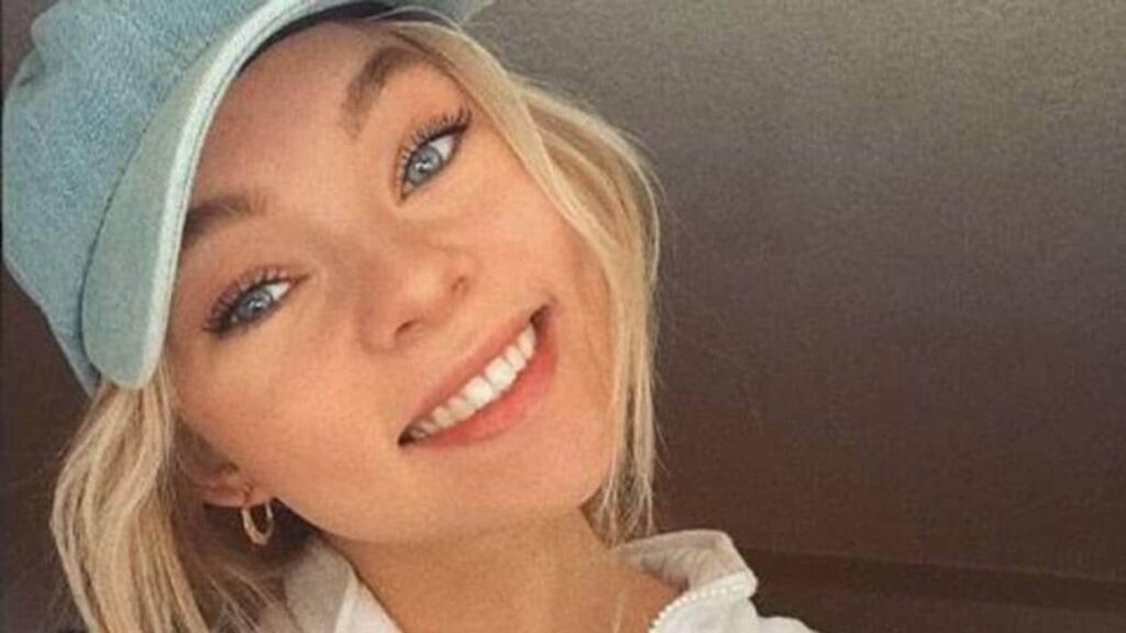 Taylor Hickson: Demanda por Cicatriz Facial Tras Accidente en Set 1 taylor hickson demanda por cicatriz facial tras accidente en set