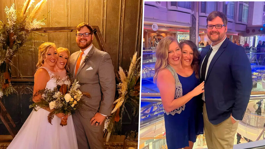 Abby Hensel Married: Detalles de la Boda de la Gemela Siamesa 1 abby hensel married detalles de la boda de la gemela siamesa